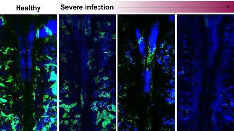 Severe Infections Wreak Havoc on Mouse Blood Cell Production