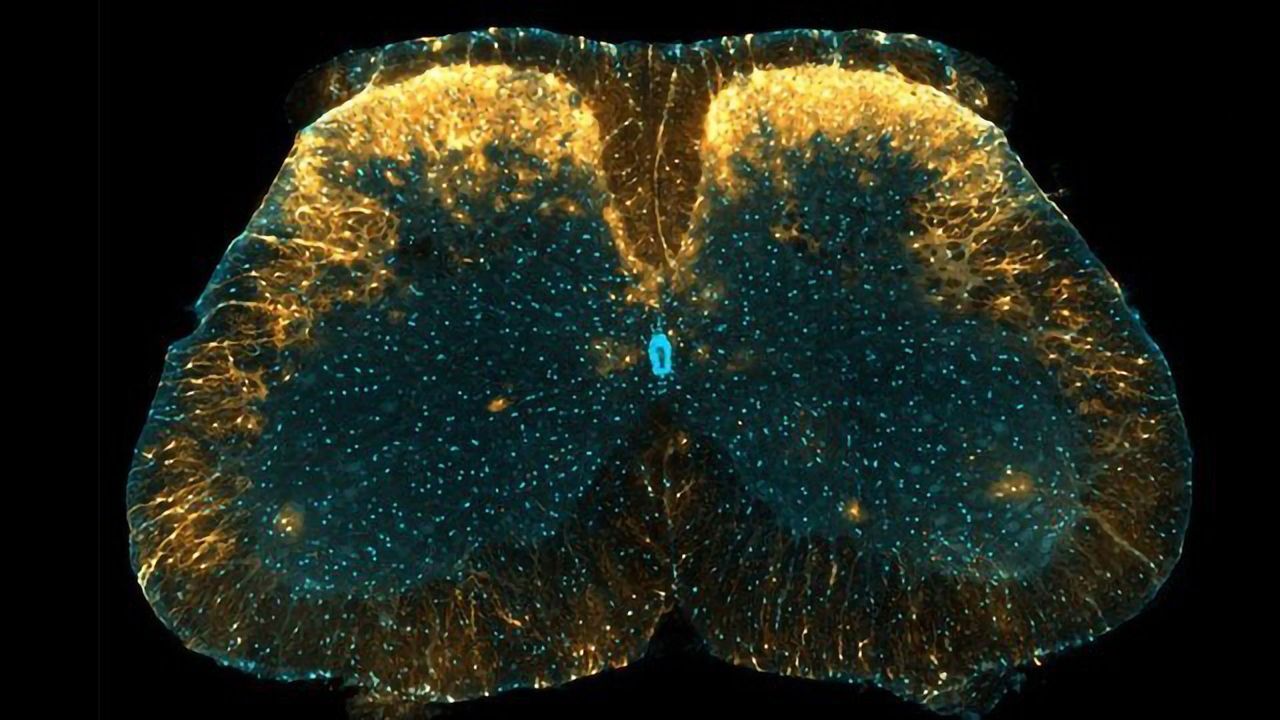 Pain Control Mechanism Could Be Exploited as a New Drug Target