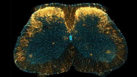 Pain Control Mechanism Could Be Exploited as a New Drug Target