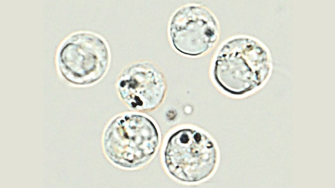 The Not-So Silver-Lining of Nanoparticles for Phytoplankton