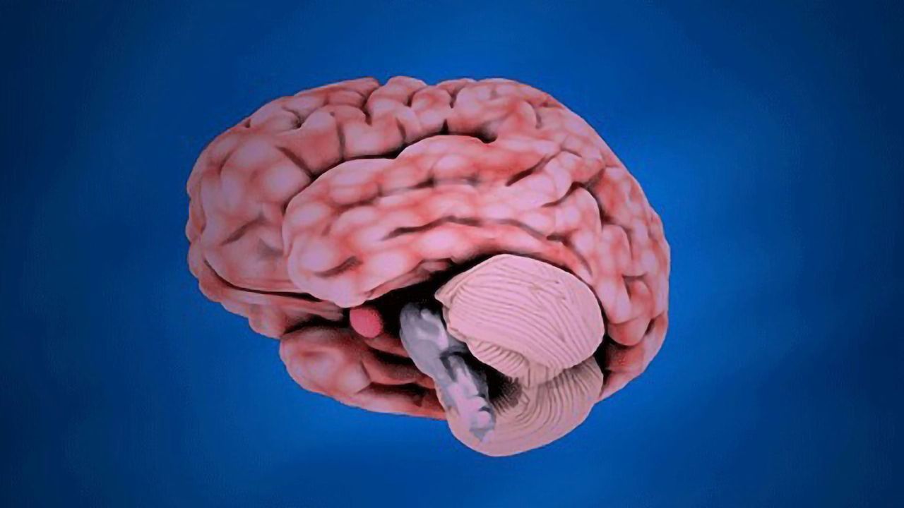 Pregnancy Stress May Influence Baby's Brain Development
