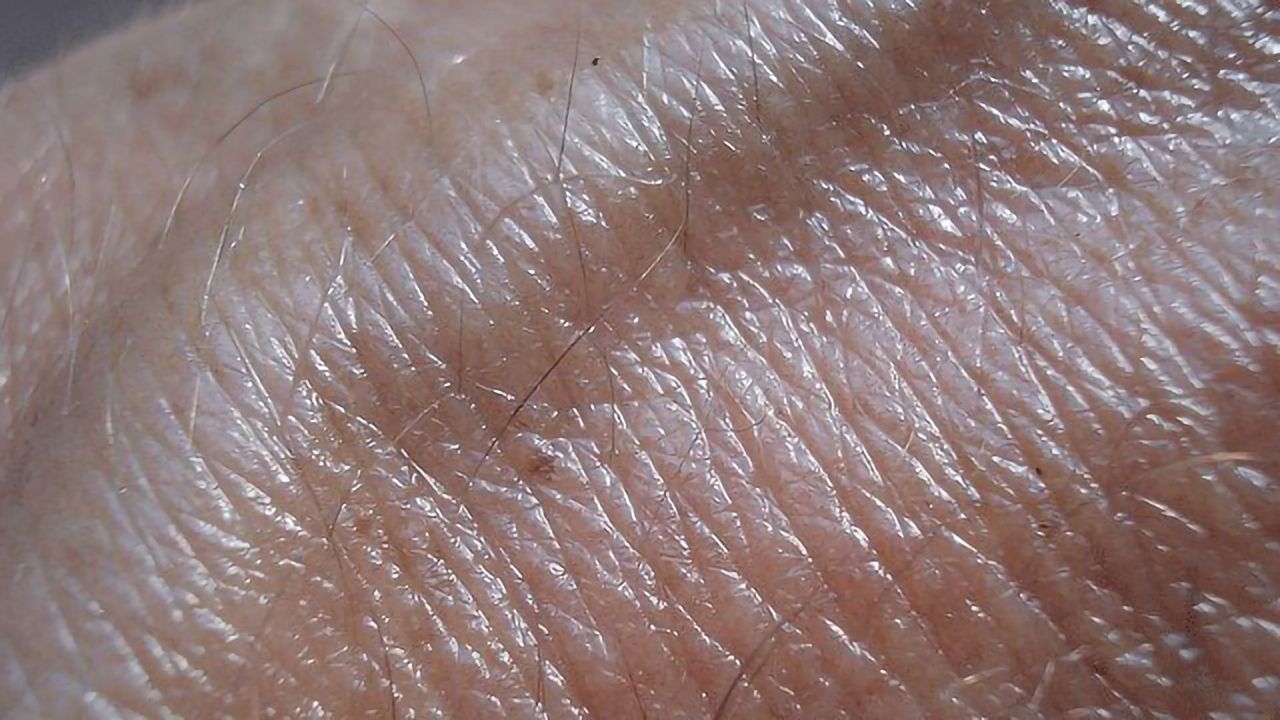 T-Rays Offer Useful Tool for Characterizing Skin Conditions