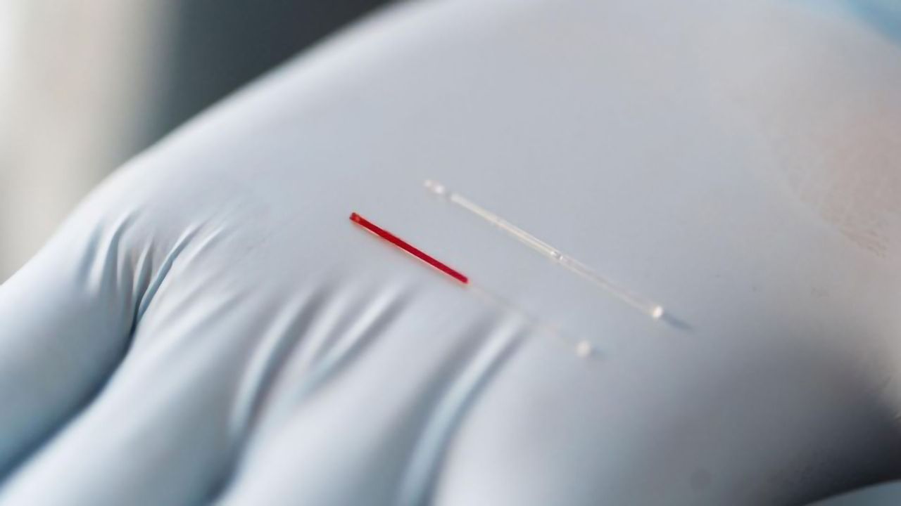 Largely Unexplored Bodily Fluid May Reveal New Biomarkers