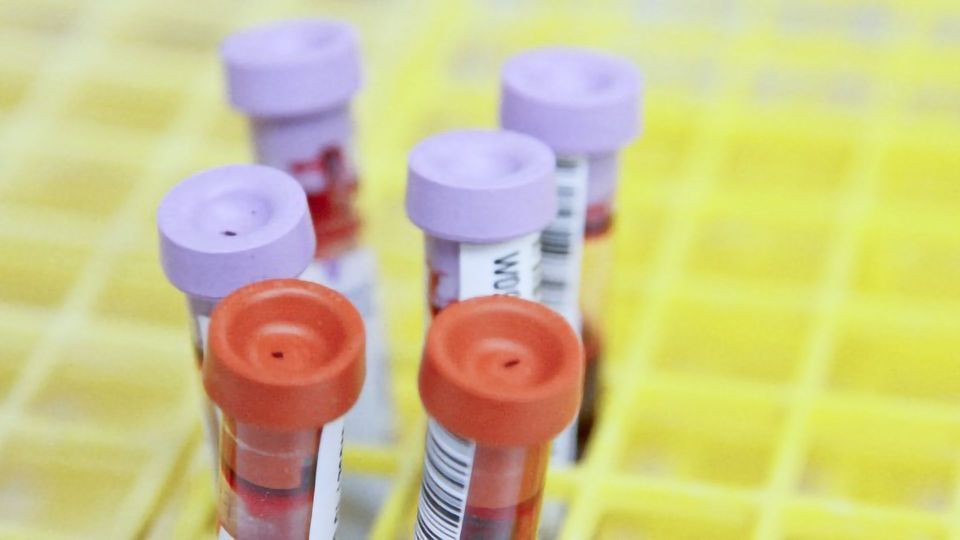 NHS Will Trial Blood Test Designed To Detect > 50 Forms of Cancer content piece image