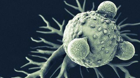 “Molecular Clock” Blood Test Could Be Used To Track Metastatic Breast Cancer