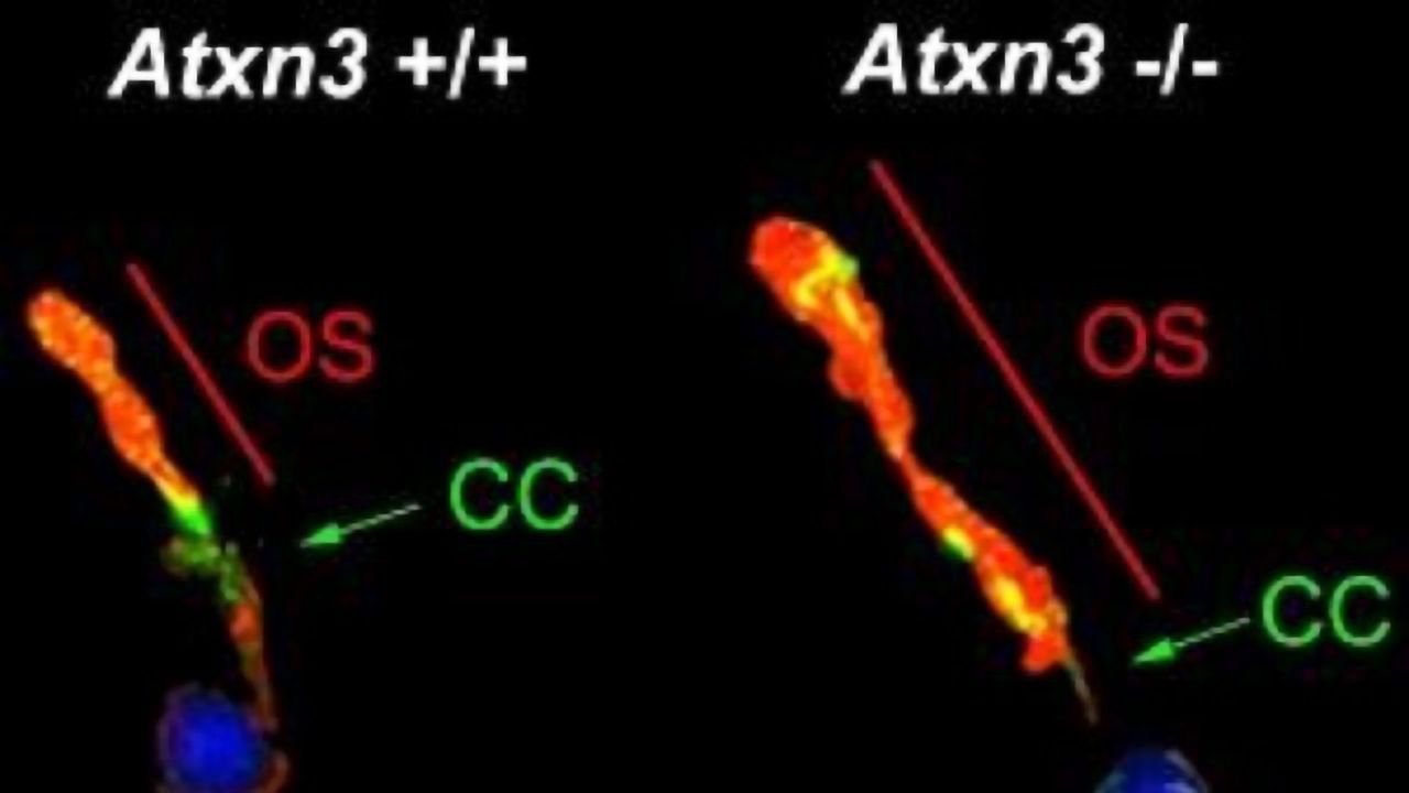 New Functions in the Gene That Causes Machado-Joseph Disease
