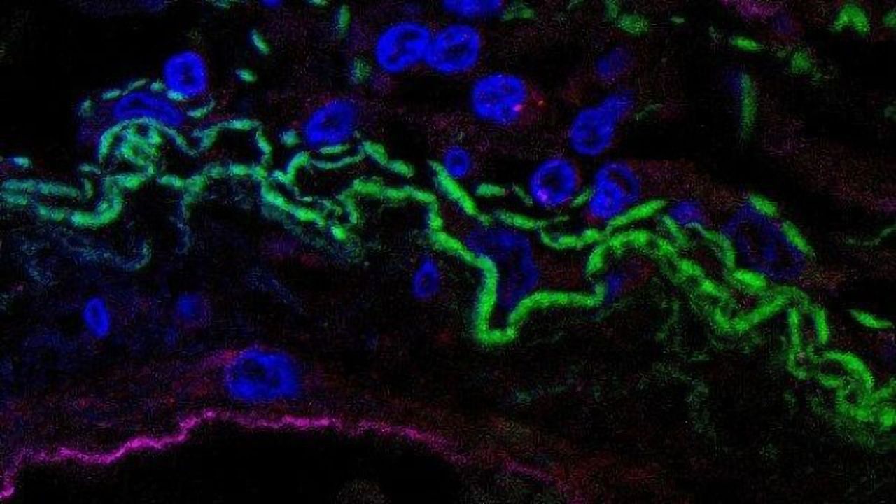 Light Shed on Immune Mechanism That Triggers Cytokine Storms Typical of COVID-19