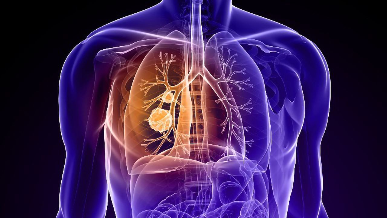 Native American Ancestry Associated With Increased EGFR Mutations