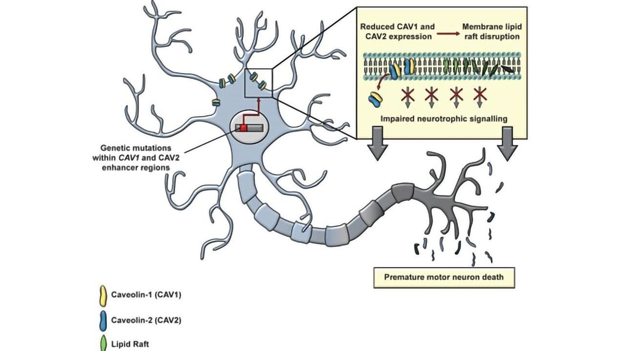 New Genetic Risk Factor for Motor Neuron Disease Identified