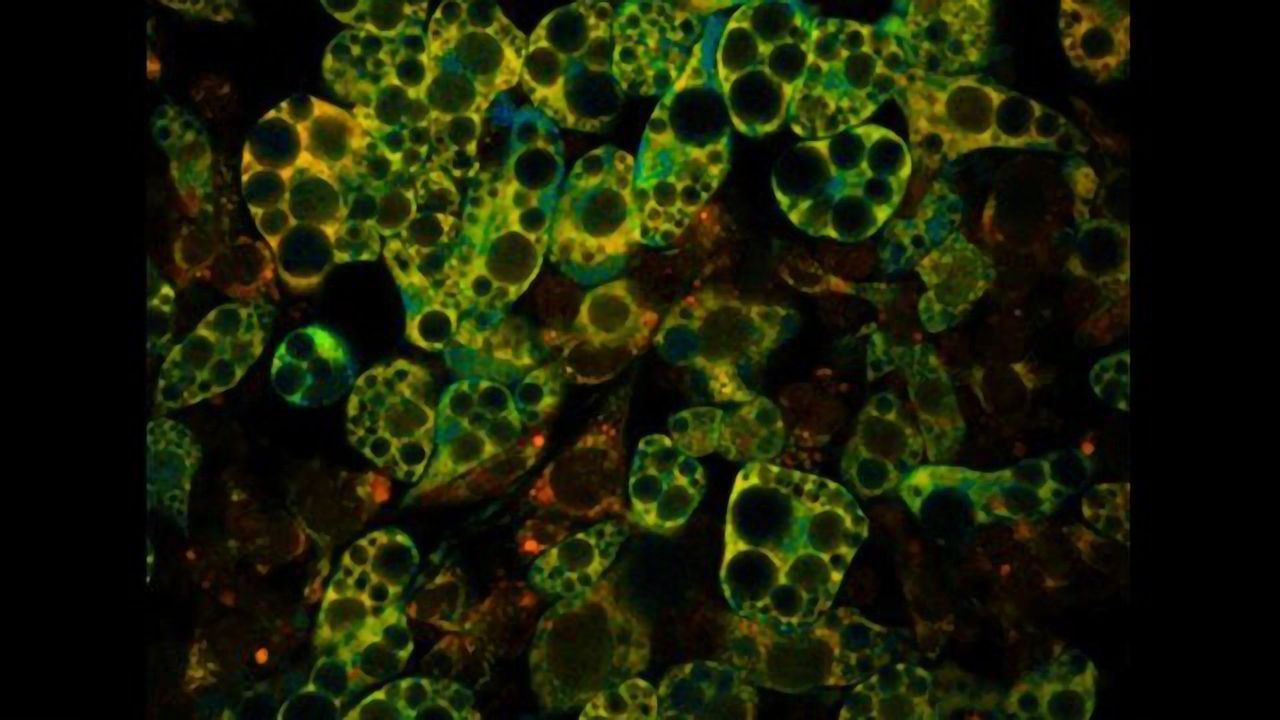 Drug Reduces Weight Gain in Mice Fed a High-Fat Diet