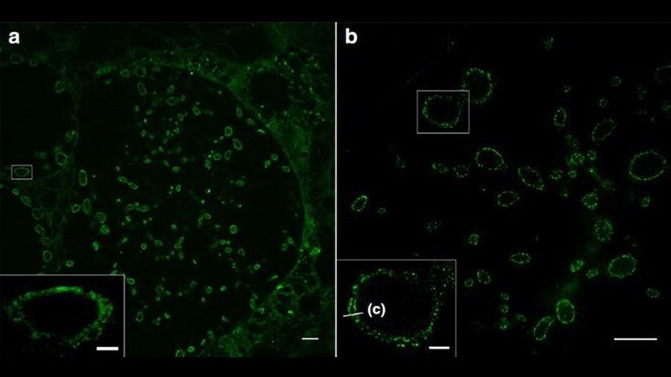 Super Resolution Detail of Cell Membranes Revealed content piece image