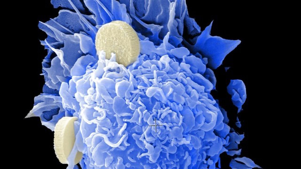 Co-Mutation Points to New Target for Aggressive Form of Lung Cancer