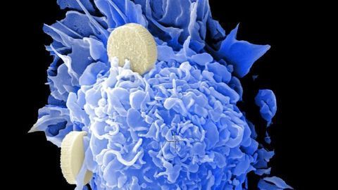 Co-Mutation Points to New Target for Aggressive Form of Lung Cancer