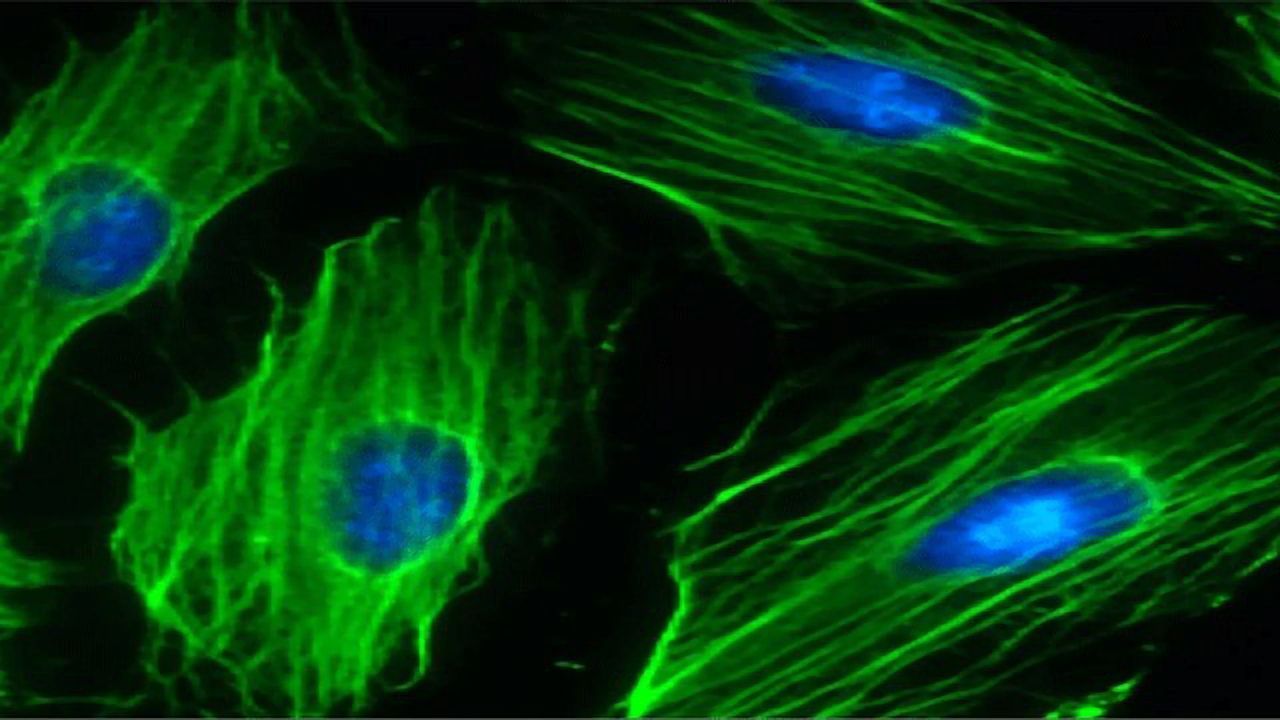 Could Gene Therapy Be Used To Mimic the Positive Effects of Exercise?