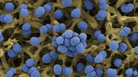 Why Do Meningococcal Bacteria Make Some People Seriously Ill and Not Others?