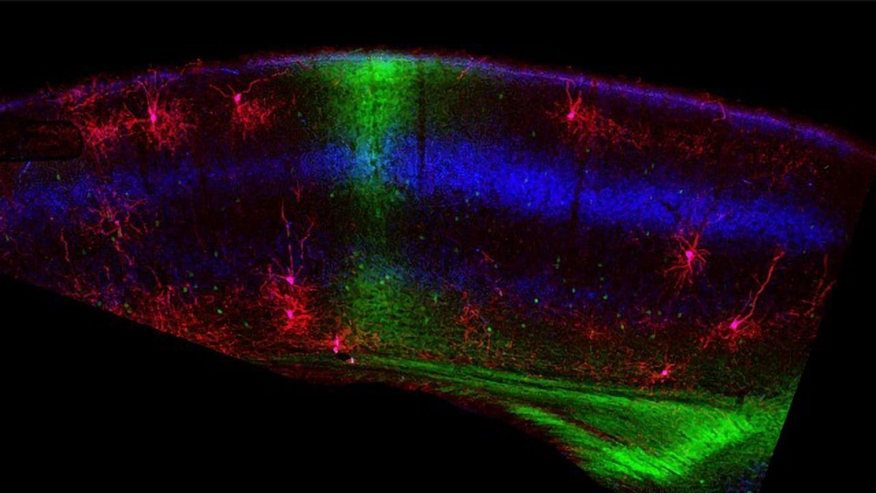 The Brain Prepares for Binocular Vision Even Before the Eyes Open