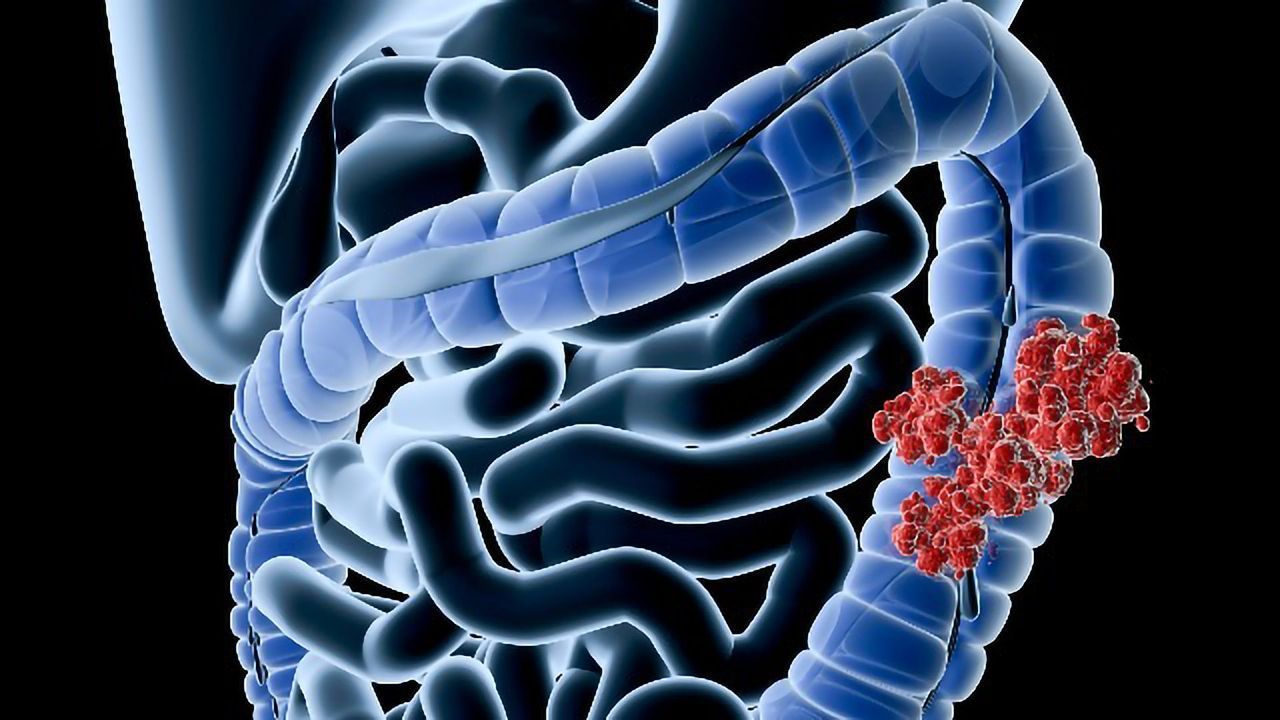 Sequencing Study Reveals the Brain in the Gut