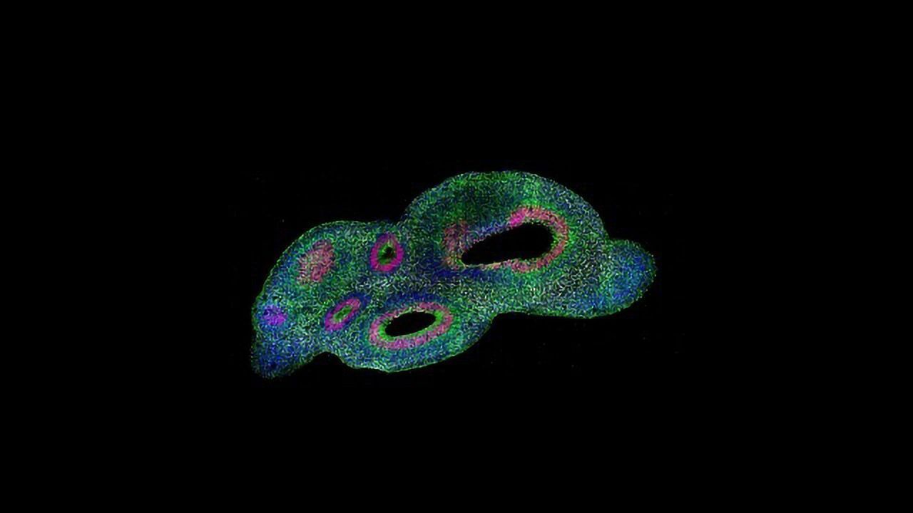 New System Helps Classify "Snowflake" Brain Organoids