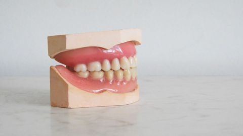 Poor Oral Hygiene May Result in Metabolic Syndrome