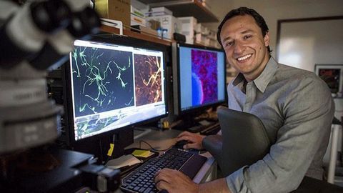 Lab-Grown Brain Organoids Mimic Genetic Form of Autism's Neural Signatures