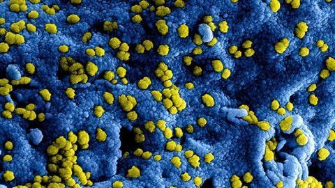 Critical Molecules That Coronaviruses Hijack To Infect Human Cells Identified