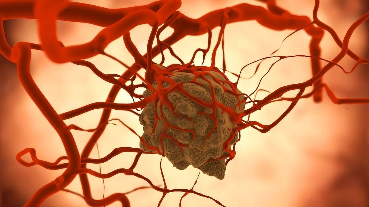 New Guidelines for Treating Complications Associated With Brain Tumors
