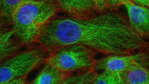 Algorithm Developed To Prevent Misidentification of Cancer Cells