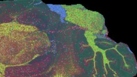 Computational Method Enables High-Resolution Mass Spectrometry Imaging Faster