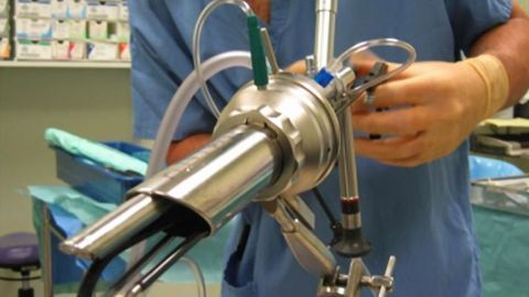 Treatment Could Prevent Life-Altering Adverse Effects Faced by Early-Stage Rectal Cancer Patients