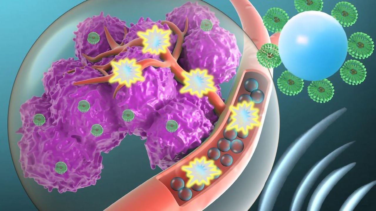 Targeting Cytotoxic Drugs to Tumors Using Microbubbles
