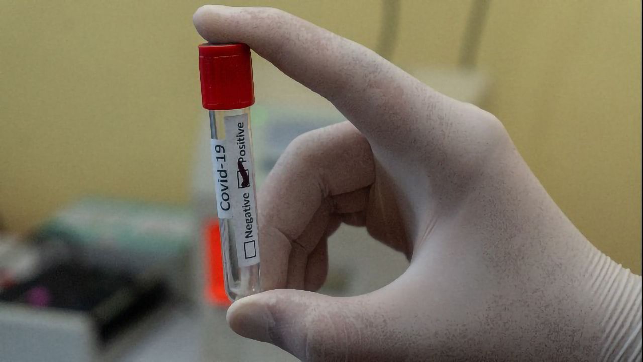 Blood Biomarkers Could Help Predict Severe SARS-CoV-2 Infection