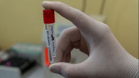 Blood Biomarkers Could Help Predict Severe SARS-CoV-2 Infection