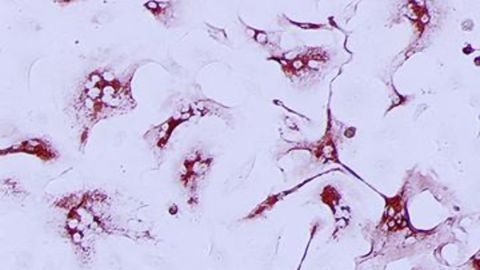 Endothelial Cell Targeting Could Help Fight COVID-19 Symptoms