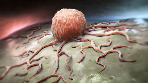 Immune Cell That Drives Breast Cancer Growth Could Be Effective Therapeutic Target