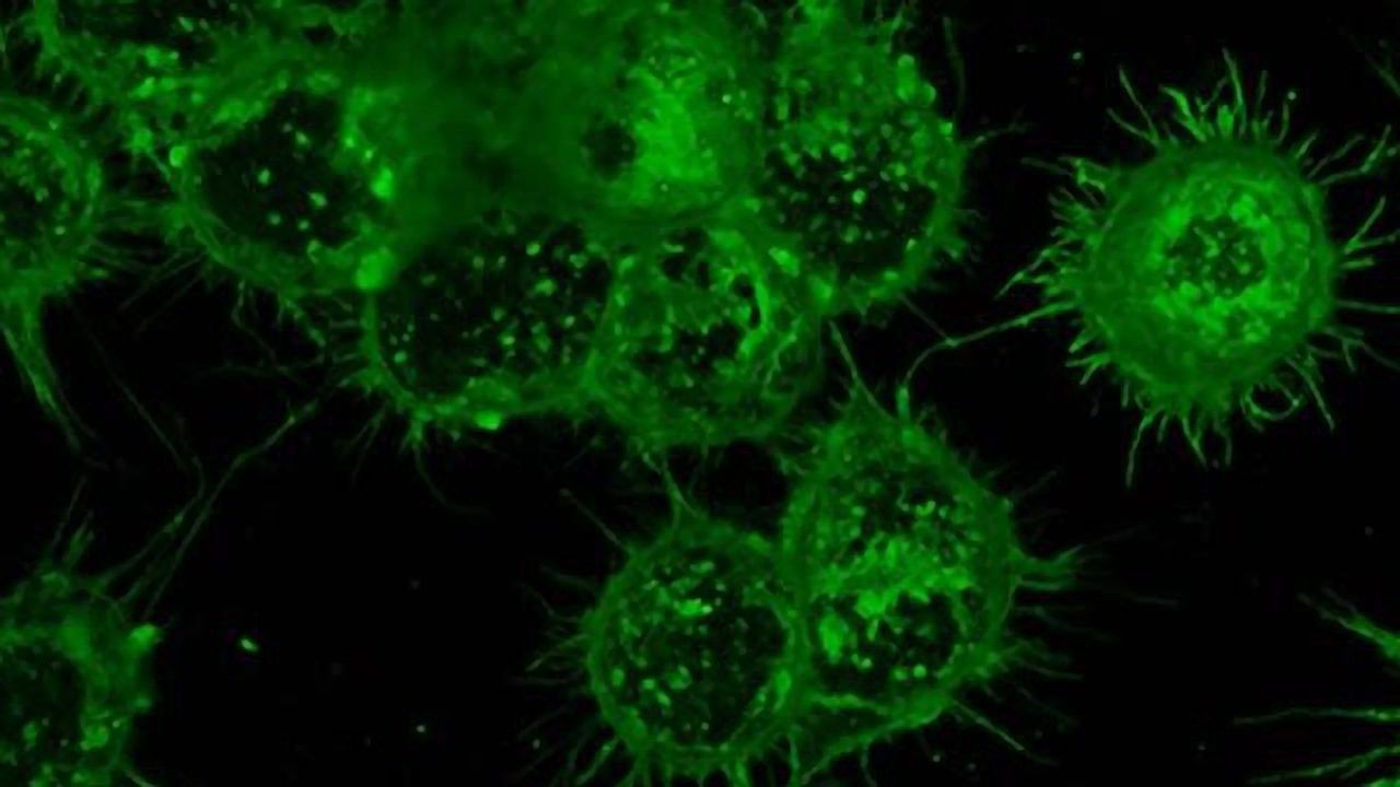 Modified “Killer” Immune Cells Kill Lymphoma Cells Whilst Sparing Healthy Ones