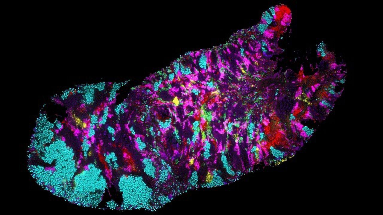 Your Mouth Is Home to Incredibly Diverse Bacteria
