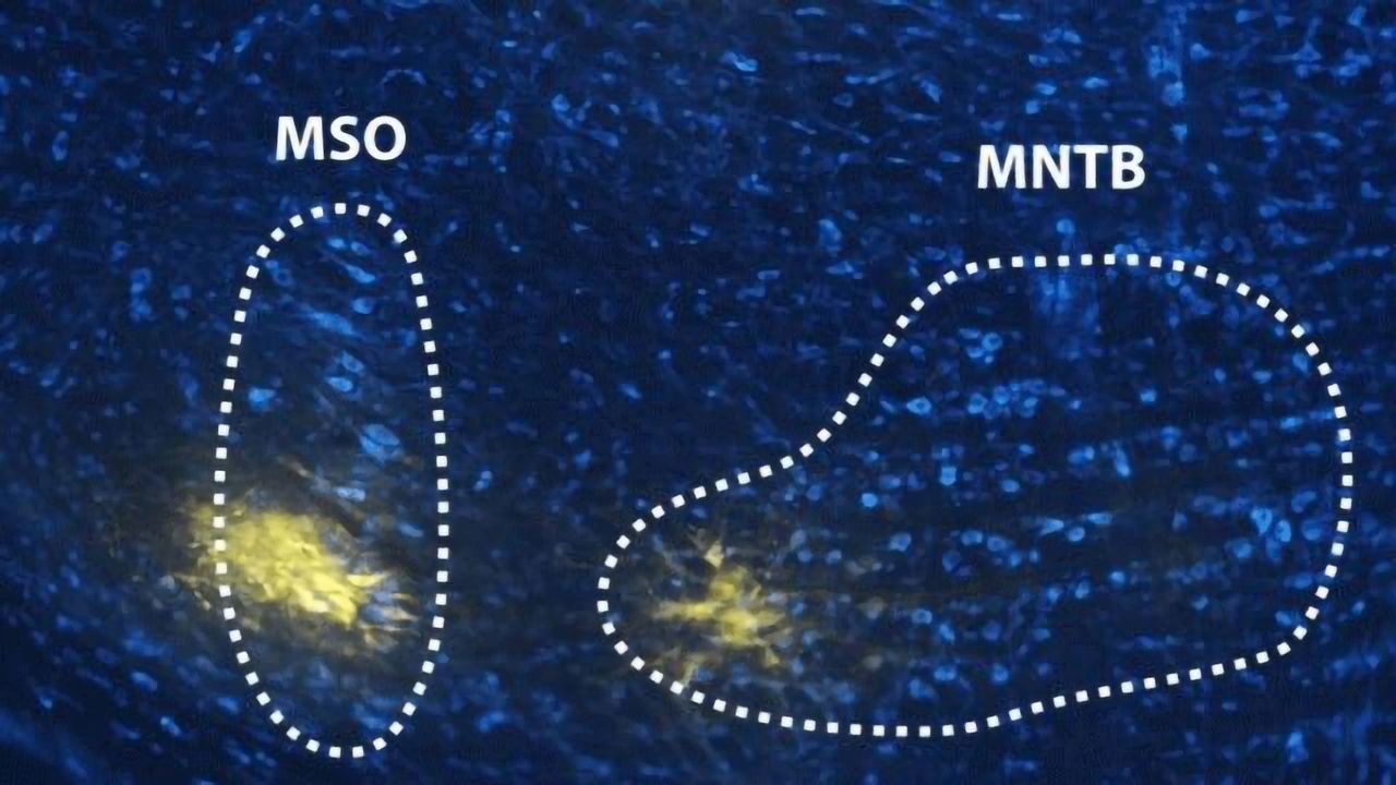 How the Brain Distinguishes Speech From Noise