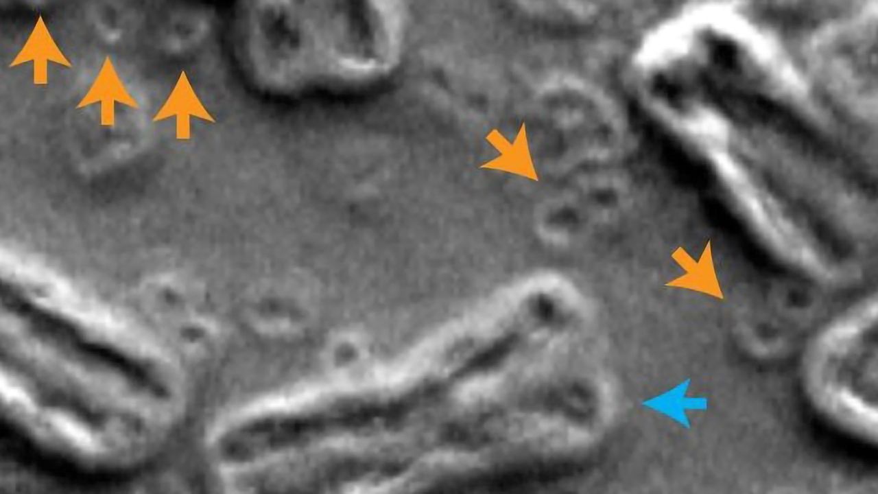 Shattered Chromosomes Help Cancer Cells Evade Treatment