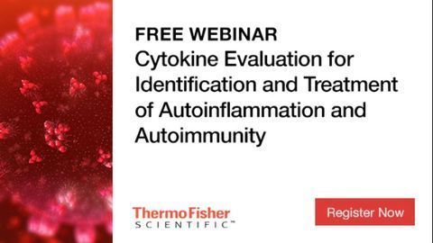 Cytokine Evaluation Can Help Establish Autoinflammatory and Autoimmune Diagnosis and Guide Treatment