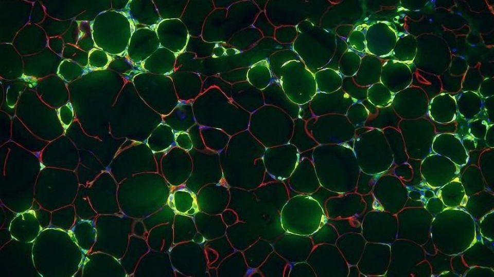 Blood Vessel Cells Implicated in Chronic Inflammation of Obesity content piece image