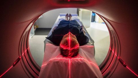 New Study Images the Brain as It Loses Consciousness