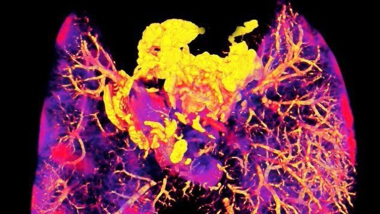 Imaging Method Reveals If Antibiotics Reach Their Target Bacteria