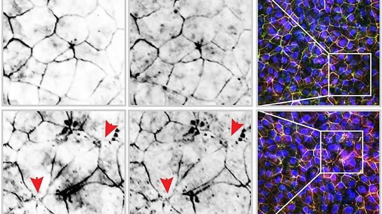 Gut Inflammation Triggered by Chemicals in E-Cigarette
