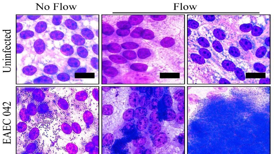 Mechanical Gut Simplifies Infection Studies content piece image