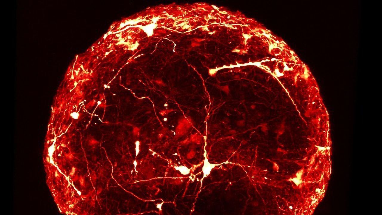 Detailed Internal Structure of a Mini-Brain Organoid Revealed for the First Time