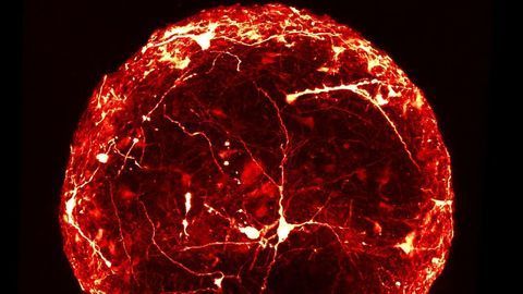 Detailed Internal Structure of a Mini-Brain Organoid Revealed for the First Time