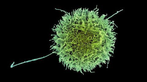 "Invisible" Stem Cells Evade Natural Killer Cells Using Immune Off-Switch
