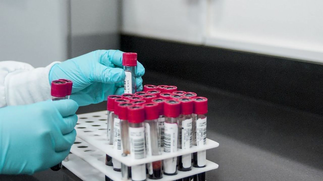 New Lab-on-a-Chip Turns Blood Test Snapshots Into Continuous Movies