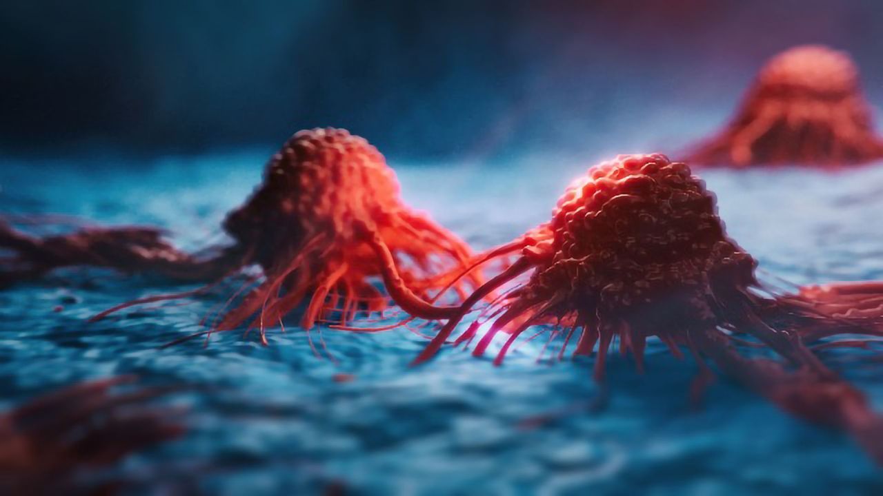 Inhibiting Glutamine Metabolism Could Be an Effective Therapeutic Strategy for <i>ARID1A</i>-Mutant Ovarian Cancer