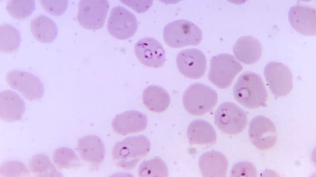 Immune Responses in Chronic Diseases May Be Driven by Tissue Stiffness